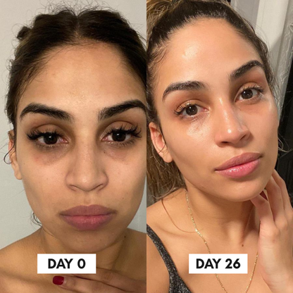 Clinical Grade Filler-like results in just 2 weeks