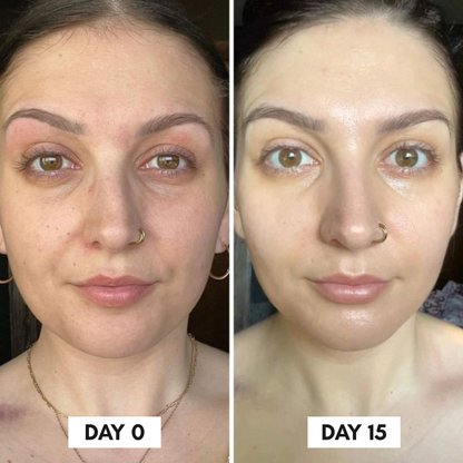 Clinical Grade Filler-like results in just 2 weeks