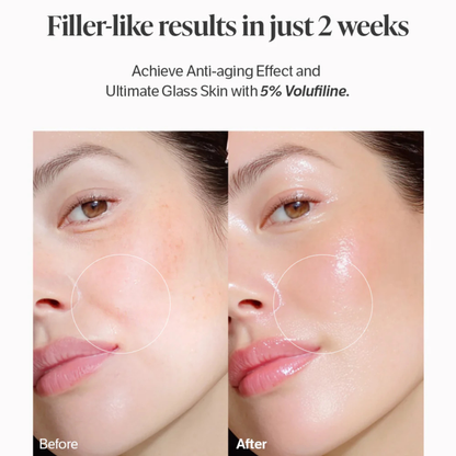 Clinical Grade Filler-like results in just 2 weeks